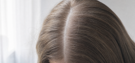 Chute de cheveux en automne : quand c’est normal, et quand il faut chercher plus loin