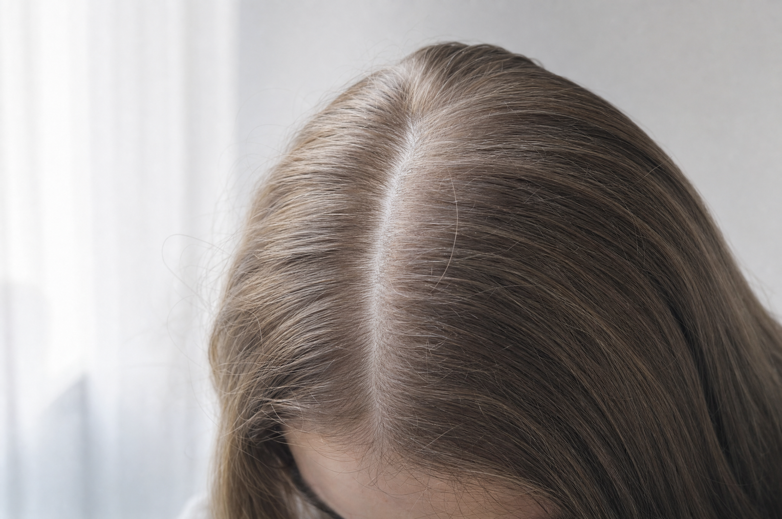 Chute de cheveux en automne : quand c&rsquo;est normal, et quand il faut chercher plus loin