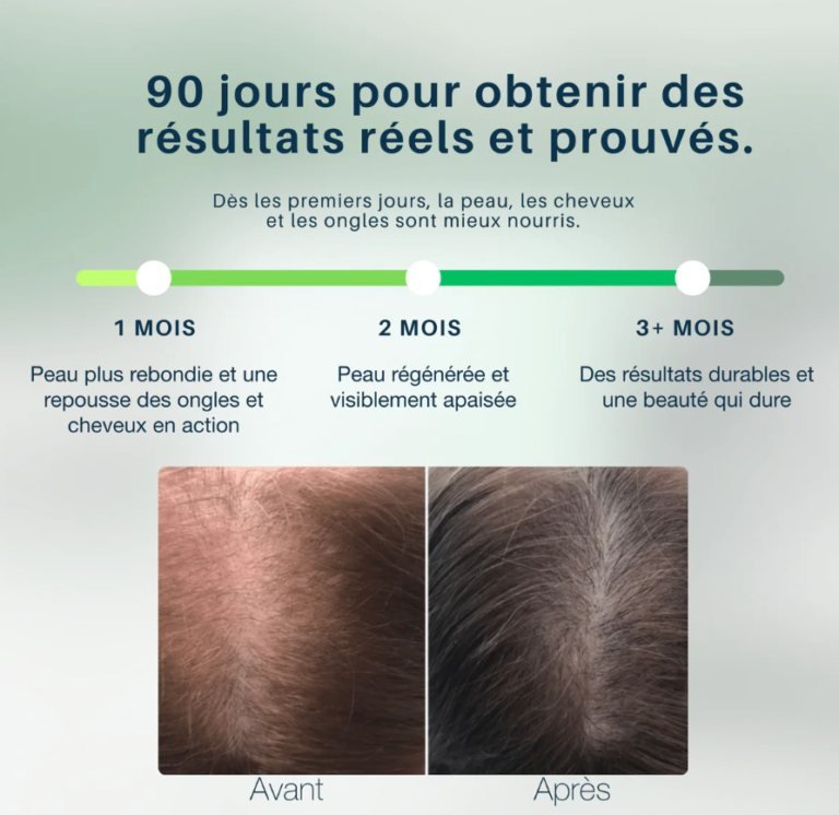 Comparaison de la densité capillaire sur une période de 90 jours